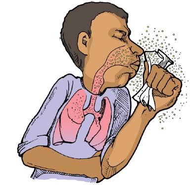 What you should know about Cough, tuberculosis